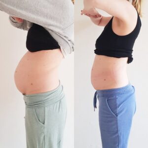 Tupler Technik Vorher-Nachher-Fotos